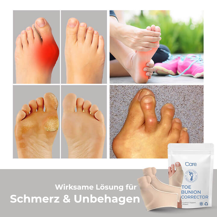 1+1 GRATIS | Orthopedische Hallux Valgus Corrector, verlicht voetpijn onmiddellijk!