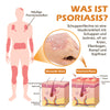 1+1 GRATIS | PsoriaHeal™ - Bijengif psoriasis behandelingsspray (geschikt voor alle huidtypes)