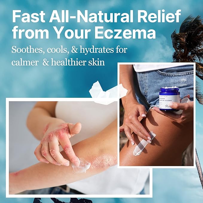 1+1 GRATIS | Ocean Eczema™ Natuurlijke verzachtende crème