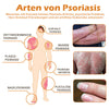 1+1 GRATIS | PsoriaHeal™ - Bijengif psoriasis behandelingsspray (geschikt voor alle huidtypes)