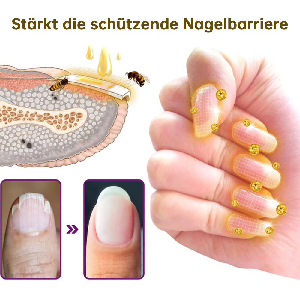 1+1 GRATIS | FungiFree™ Schimmelvrij bijengif nagelbehandelingsserum