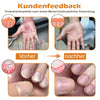 1+1 GRATIS | PsoriaHeal™ - Bijengif psoriasis behandelingsspray (geschikt voor alle huidtypes)