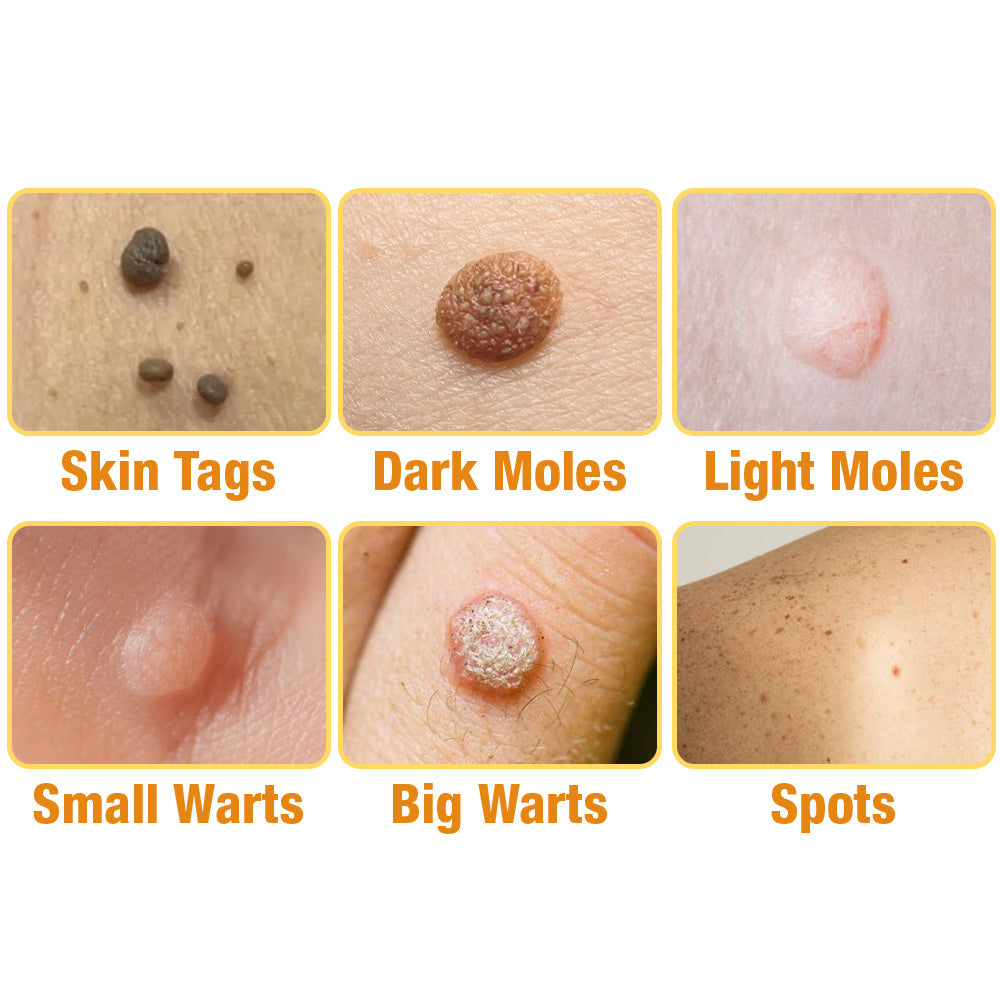 1+1 GRATIS | Bijengif behandelingsspray, De revolutie in huidverzorging met een buzz-effect.