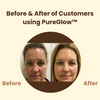 1+1 Gratis | PureGlow™ Resultaat direct zichtbaar!